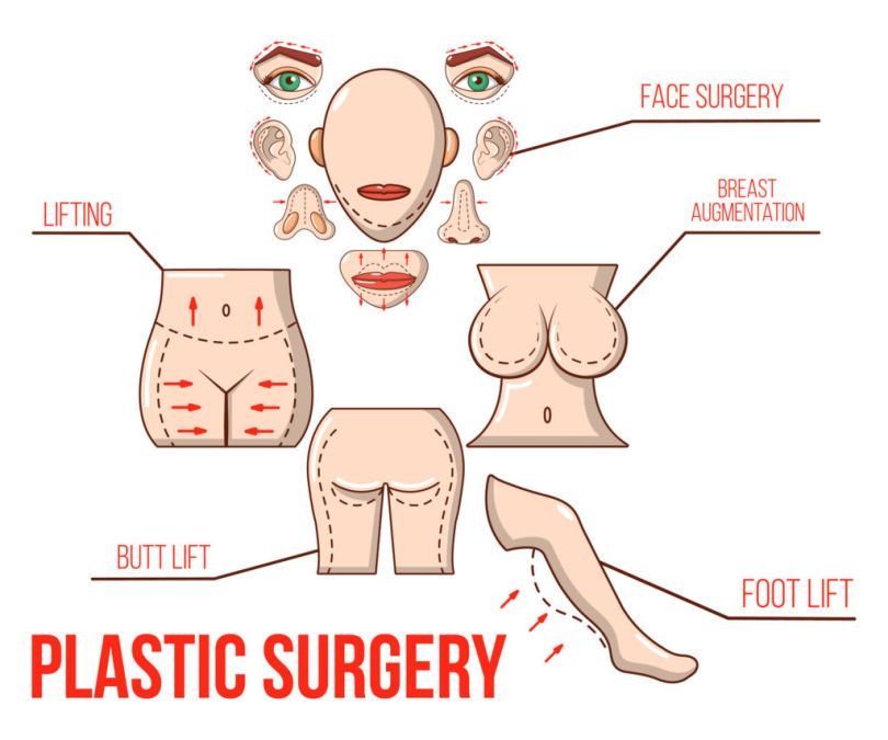 chirurgia plastyczna